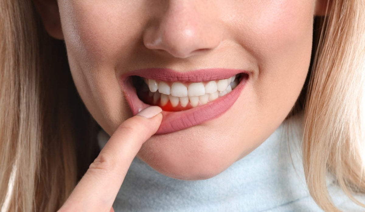 Foods That Help Fight Gum Disease